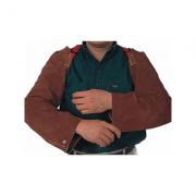 ������44-7022�����ֱۺͼ粿�Ŀ���ɫƤ����